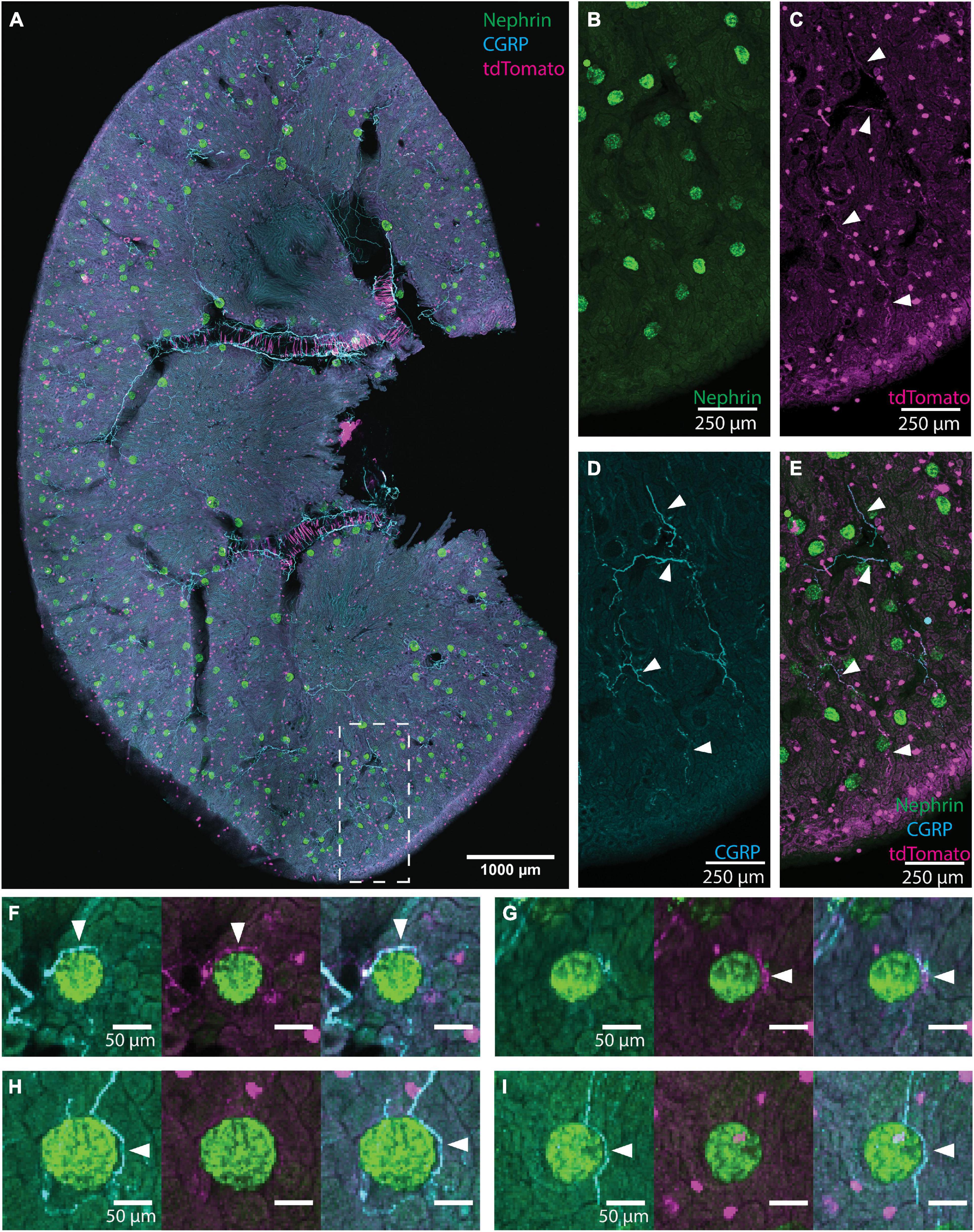 Periglomerular afferent innervation of the mouse renal cortex